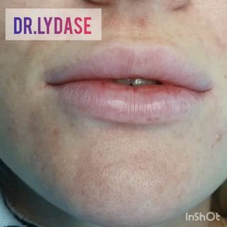 One of the top publications of @dr.lydase which has 28 likes and 1 comments