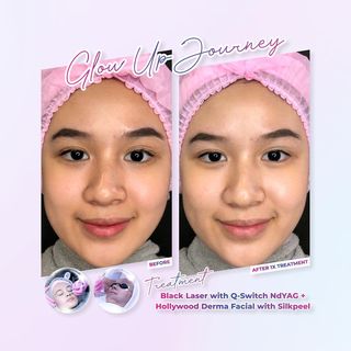 One of the top publications of @airinbeautycare which has 555 likes and 27 comments