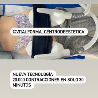 One of the top publications of @vitalforma_centrodeestetica which has 26 likes and 4 comments