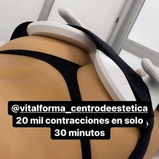 One of the top publications of @vitalforma_centrodeestetica which has 31 likes and 2 comments