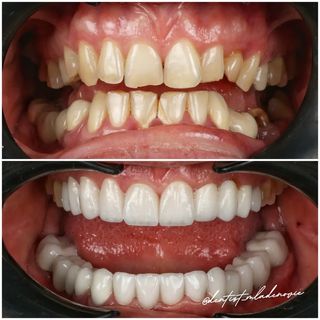 One of the top publications of @dentist_mladenovic which has 155 likes and 0 comments