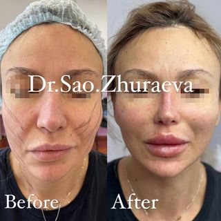 One of the top publications of @dr.sao.zhuraeva which has 207 likes and 12 comments