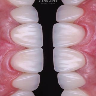 One of the top publications of @dsd.dentaldesigner which has 16 likes and 0 comments