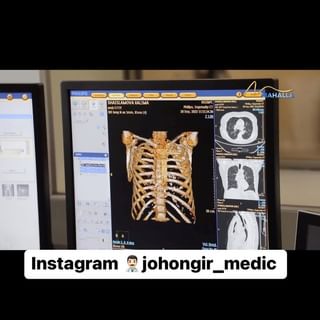 One of the top publications of @johongir_medic which has 20 likes and 0 comments
