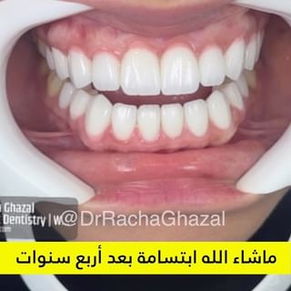 One of the top publications of @drrachaghazal which has 37.3K likes and 137 comments