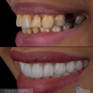 One of the top publications of @libertydentalclinic which has 35 likes and 4 comments