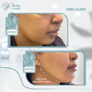 One of the top publications of @hebaclinic_ which has 2 likes and 0 comments