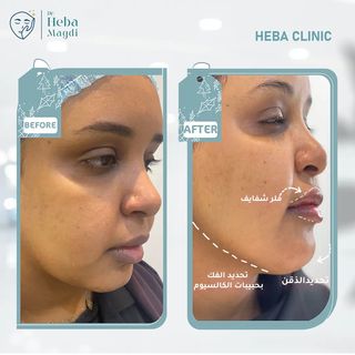 One of the top publications of @hebaclinic_ which has 5 likes and 1 comments