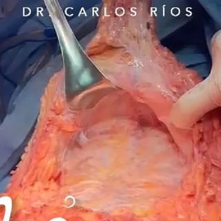 One of the top publications of @dr.carlosrios which has 705 likes and 65 comments