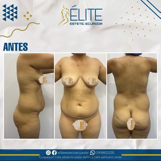 One of the top publications of @elite_cirugias which has 19 likes and 0 comments
