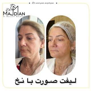 One of the top publications of @dr.maryam_majdian which has 3K likes and 40 comments