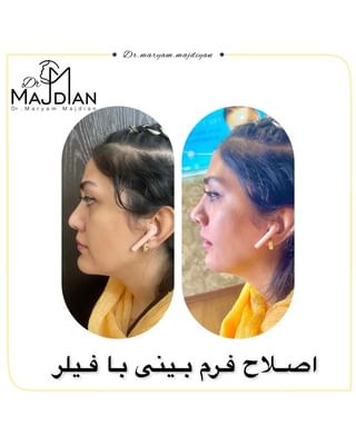 One of the top publications of @dr.maryam_majdian which has 3.3K likes and 11 comments