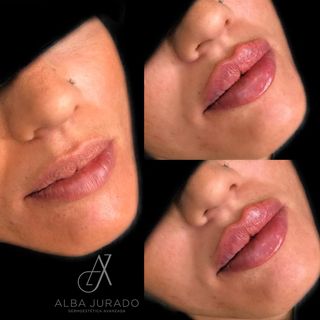 One of the top publications of @alba_dermoesteticaavanzada which has 50 likes and 9 comments