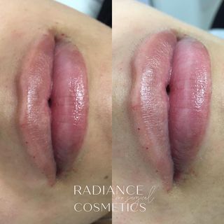 One of the top publications of @radiancecosmetics_ which has 15 likes and 1 comments