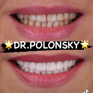 One of the top publications of @dr.polonsky which has 9 likes and 0 comments